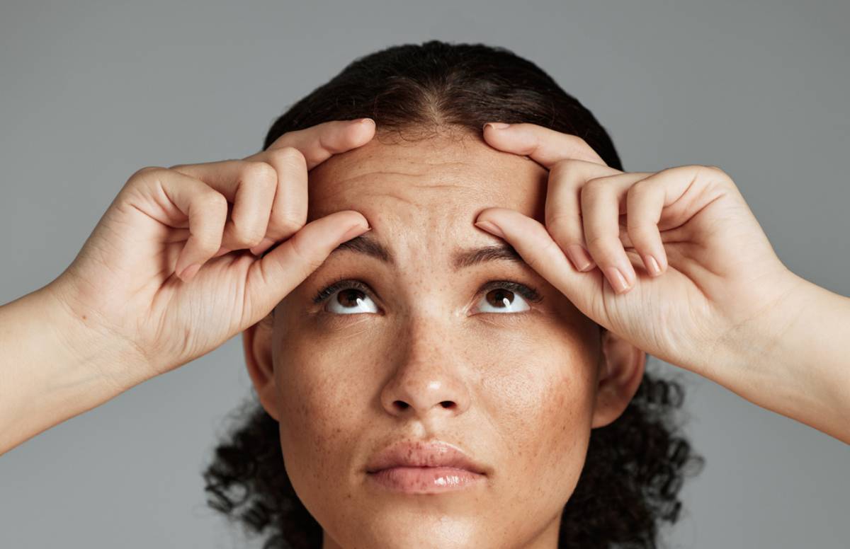 Featured image for How to Remove Forehead Wrinkles