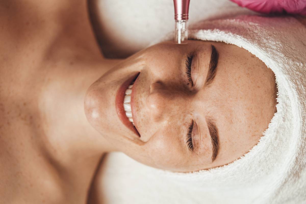 Woman receiving microneedling treatment.